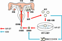 广州做试管婴儿前需做哪些准备？消化内科影响试管移植吗