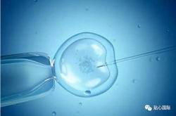 中国试管婴儿第一例不孕新突破！人工卵巢生育疗法给你一个健康的宝宝