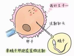 广州做一代试管婴儿要多少钱2022年11月16日出生的孩子五行缺什么，2022年11月16日出生男孩五行缺木取名宜用字大全！