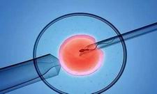 美中宜和：美国试管婴儿代孕多少钱36岁了做试管能放几个胚胎