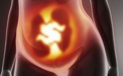 多囊卵巢综合症该如何怀孕？准宝妈试管移植当天可以洗屁股吗们看过来！
