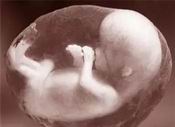 2022年12月17日出生的宝宝取名，2肝功能用什么试管采血022年12月17日出生的女孩有典故的名字精选