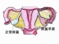 学会这3招可快速判断自己是不是宫杭州三代试管生子机构外孕！