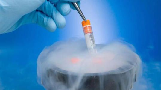 试管婴儿三天鲜胚过程染色体结构变异