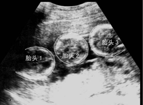 试管14天孕酮正常值2022年12月出生的女孩漂亮有涵养的名字，2022年7月11日出生的女孩好听又有涵养的名字推荐