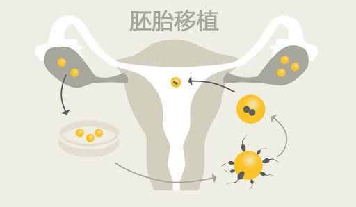 北京中科建都试管咨询中心专家告诉你什么是试管试管胚胎npn是什么意思婴儿呢？