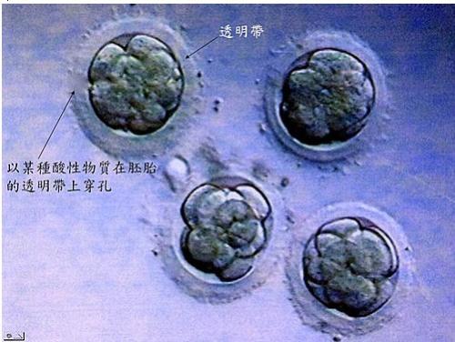 北京试管成功机率医院南宁多年不孕不育患者治疗成功怀孕报喜案例