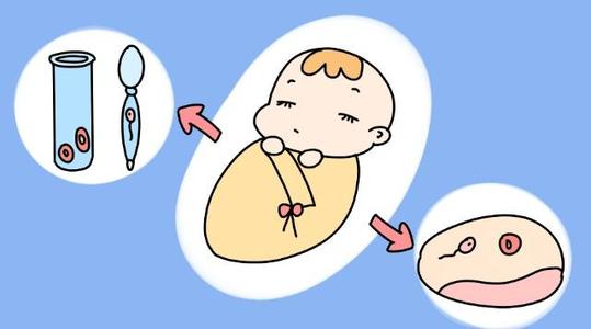 母乳性腹泻妈妈怎么吃别因自己饮食习惯害了宝宝试管婴儿哪里做得好